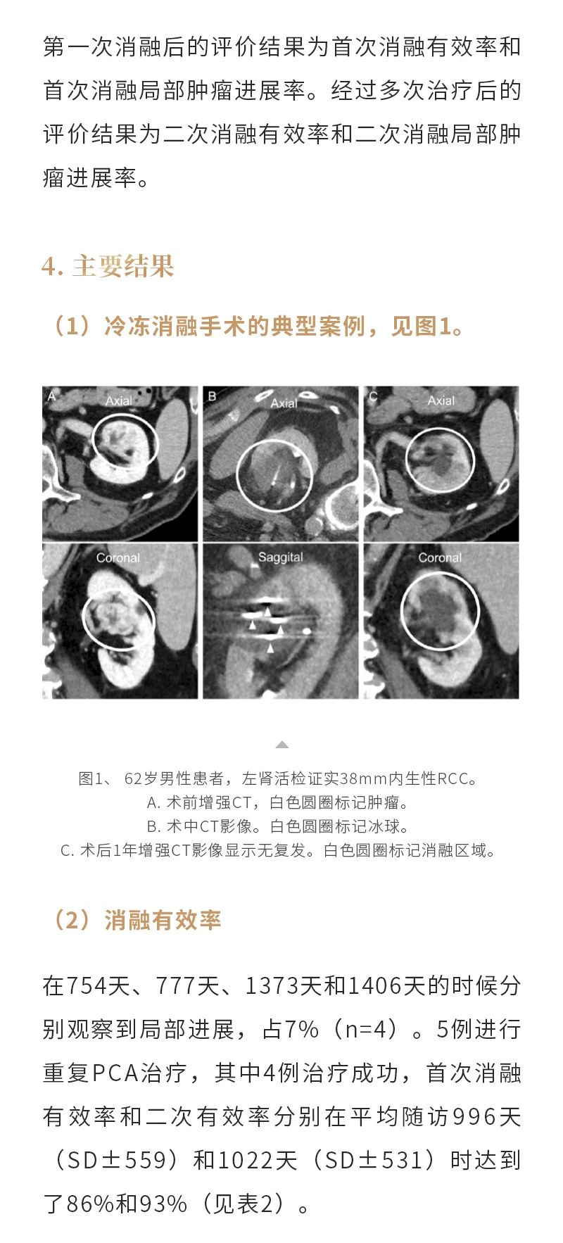 WNLgCS6xss11ShUbA8VLebu5zUHQ2dD80sOrJom4