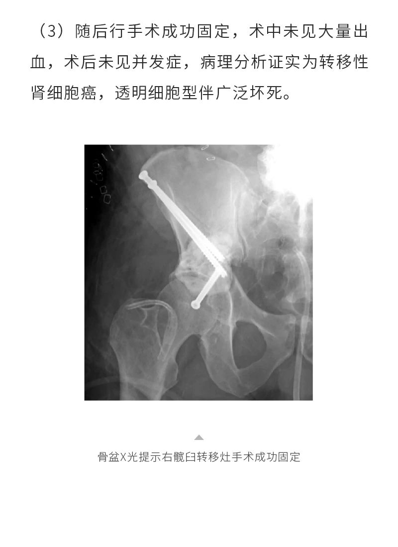 q7kDg2WKPRGdMGQnwV9itEKABZtgE1ddwsAbLeIg