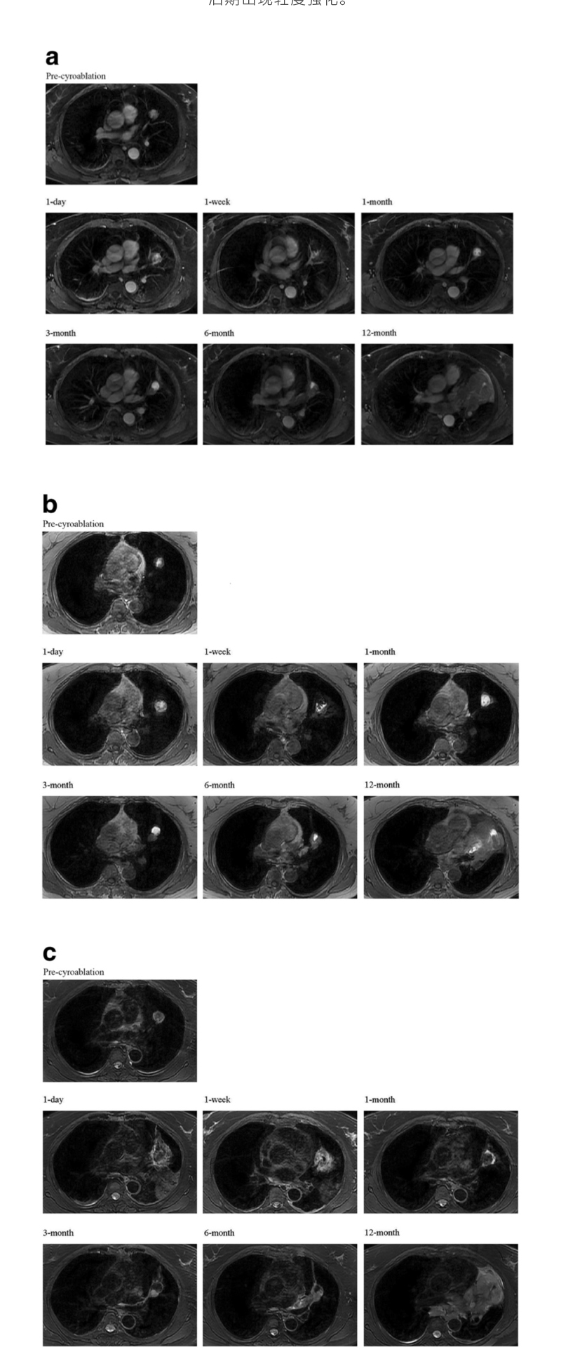 96y8EpCftQwM8rP8NGpZy6espMxJrlCDUw7T2xpS