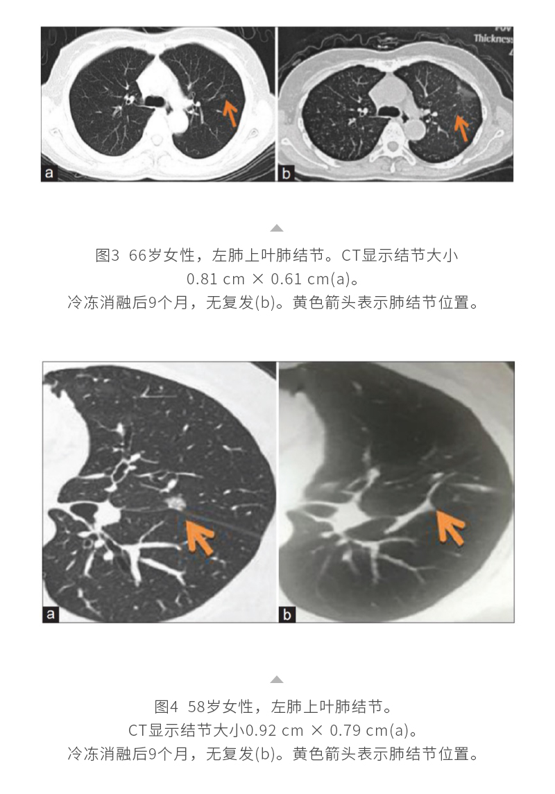 N7OLtQ84x6ASLFTkBRpkLJ2m6BXCZRe41fXoKtJK