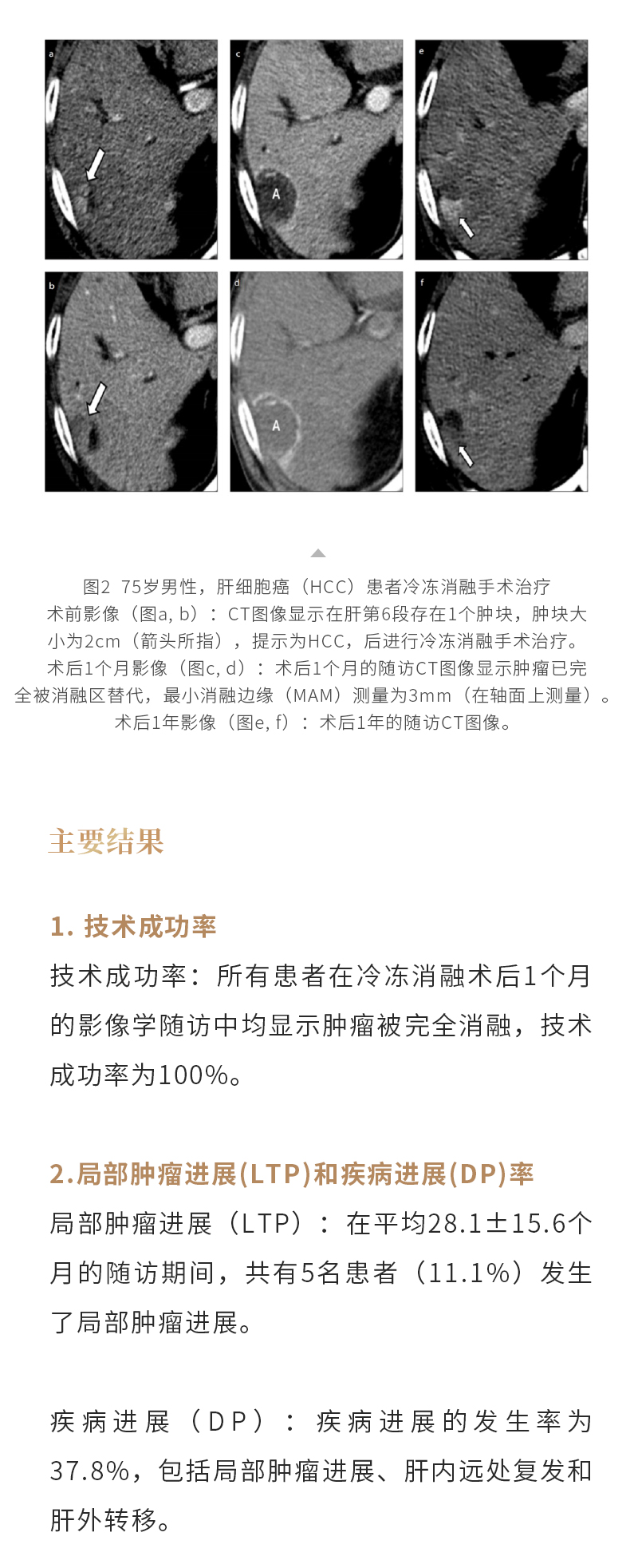 64Pe3QjwIGzsJIZrdVh0L1Z9z6NPGlkJIu3wmlpq