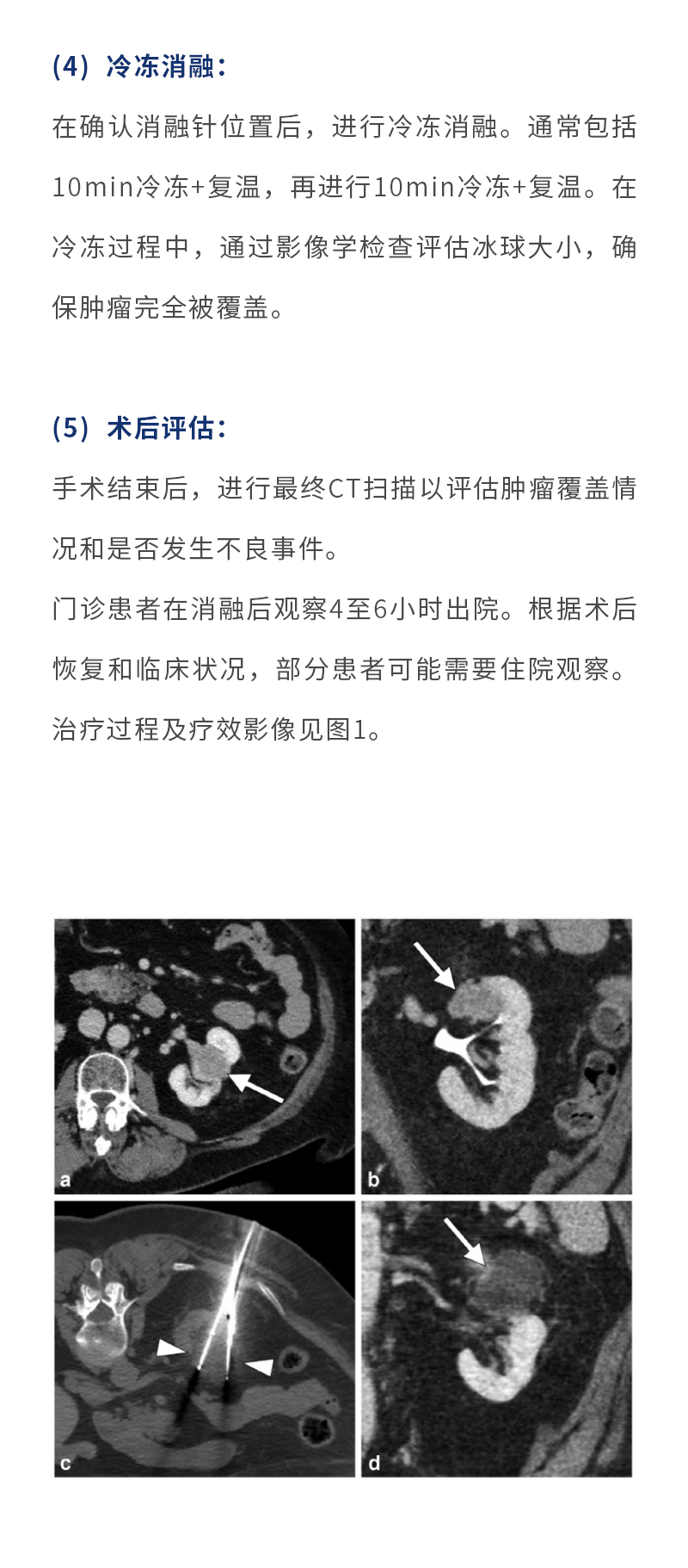 D4wocl8PQb4Bu2UXK6cW6imfiMIvglnT18V7bpdj