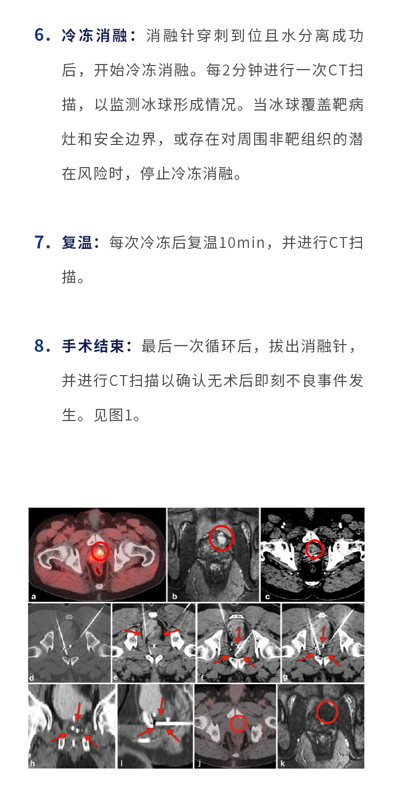 l9J33F5XGHNLhS60NF48OpDdnIiepEAG79lag9eL