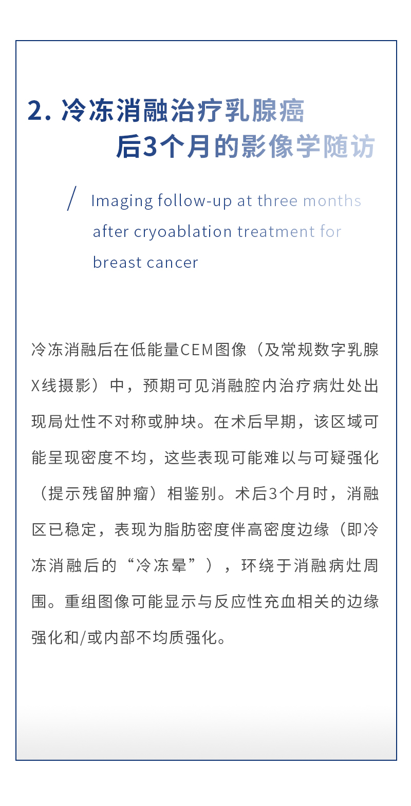 1HyZcuyDSbBBC8ud73vVakMT4RtsyDCGHgFUqQKC