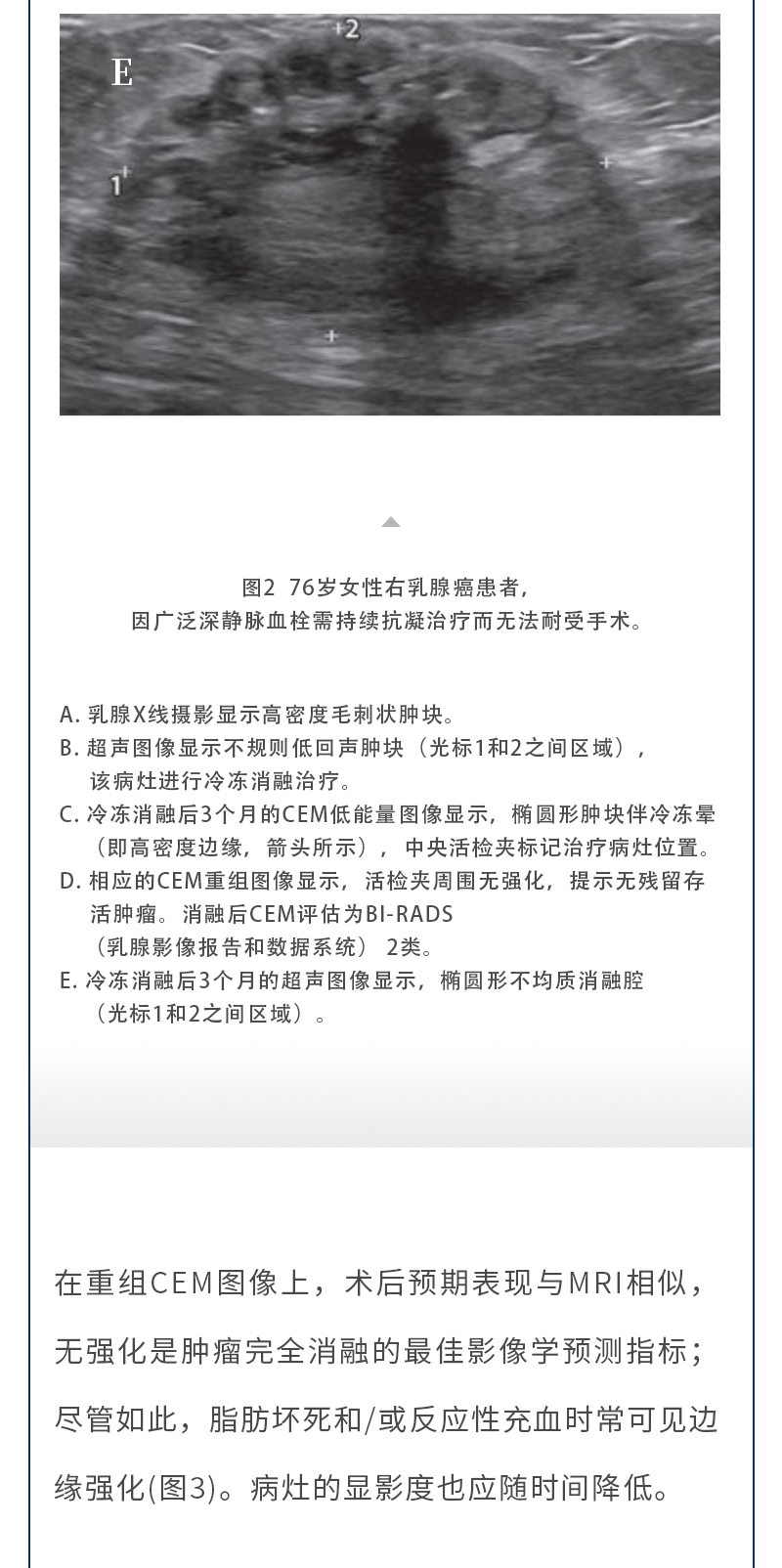 TaPwvm9oCIzFPhyRCnSQVfF1lMXsO5o9YouLrIwh