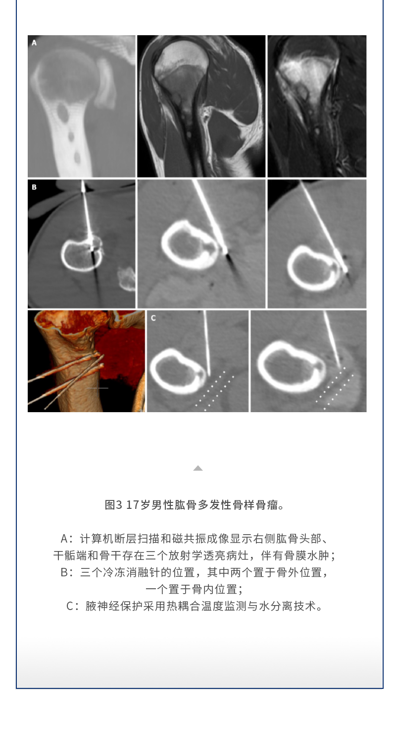 ELOYfGeuvKE2X3i4EHgaug4tJX3CODmNZkbGIZnF