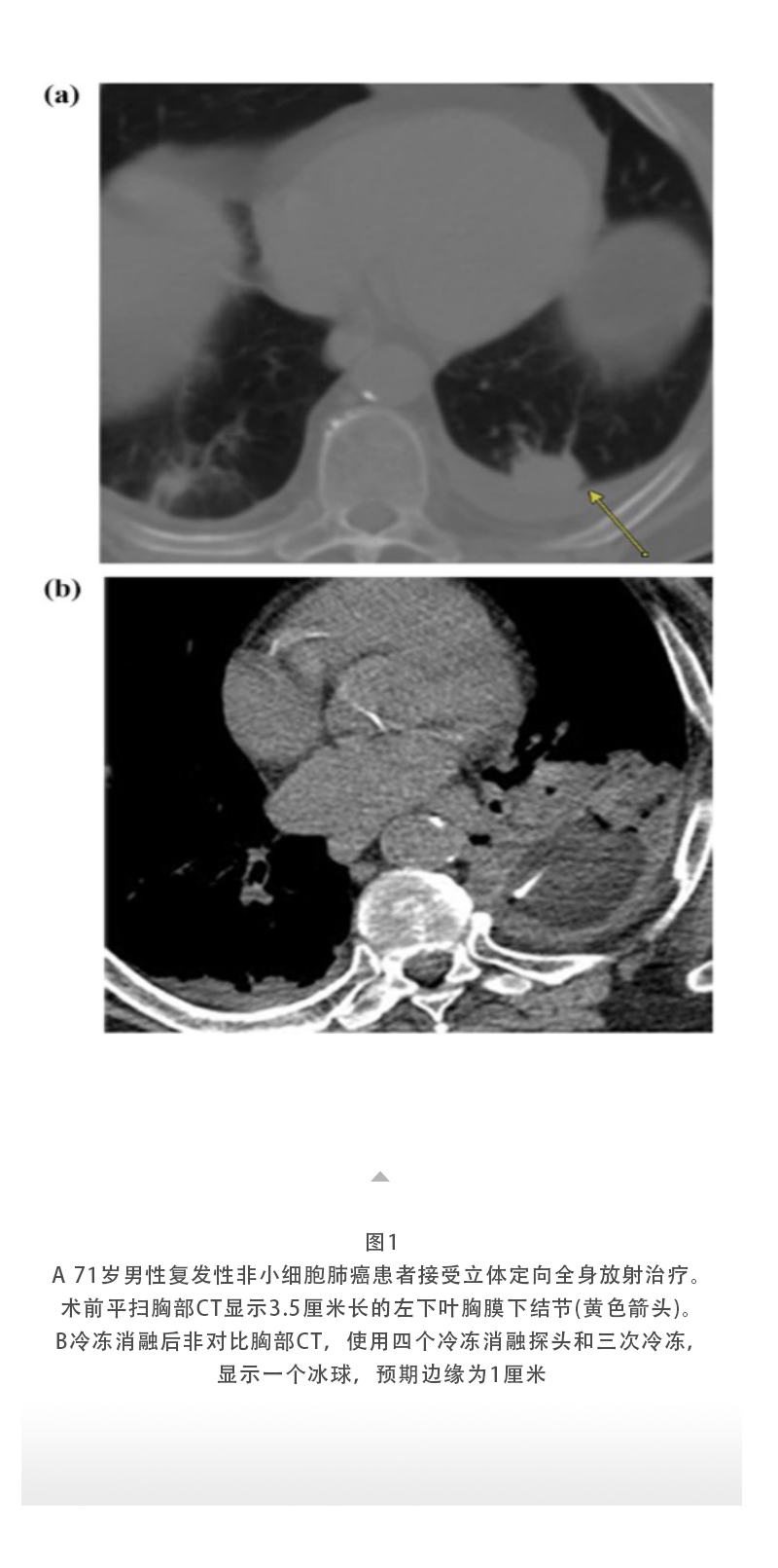 C8yJXB5as00F131IweTUCSI4RSUJVVC4dFDOe3lR