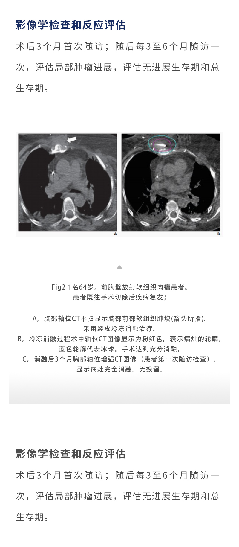 Wj6VRdtLicxQ8zin6gj49dXBZCLG1TkegDTM19ZH